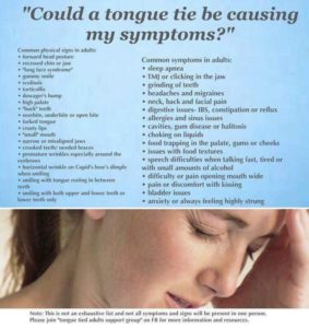 tongue tie symptoms, tongue tied adults support group